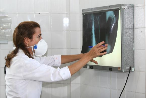 O tempo de análise para diagnosticar a tuberculose passou de oito horas para apenas dois minutoseAgecom Bahia