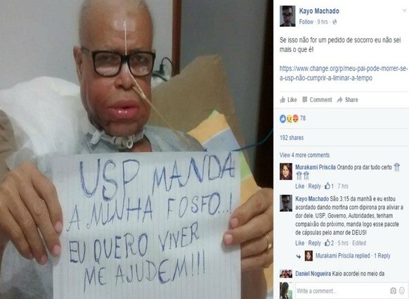 Élio de Carvalho, 58 anos, luta contra o câncer